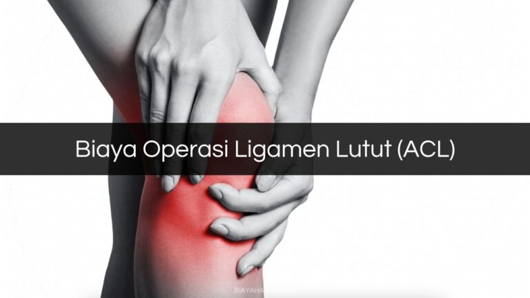Biaya Operasi Ligamen Lutut (ACL) 2023