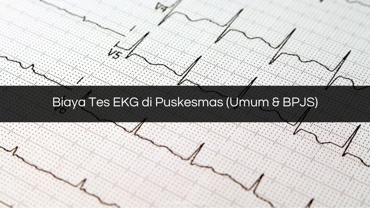 Biaya Tes EKG di Puskesmas (Umum & BPJS)