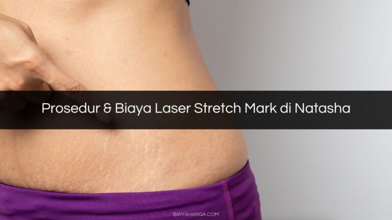 Prosedur & Biaya Laser Stretch Mark di Natasha